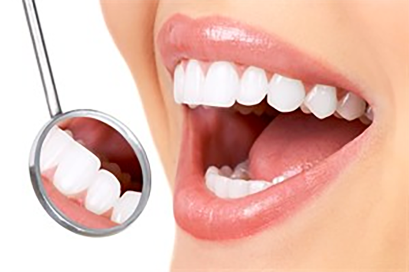 Quality & Affordable Dentist In Falcon 5907f3b47e417148adfdb797 gen dental care.webp