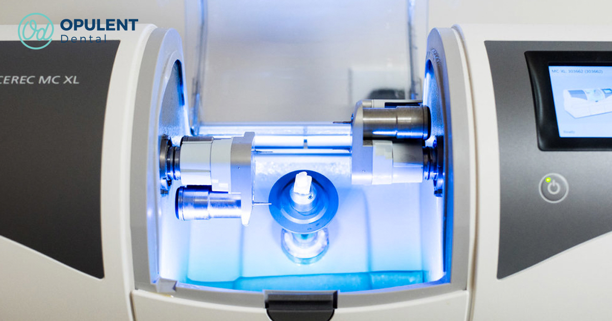 Articles 6094a07af1beb546e0bb134d cerec s1 od.webp